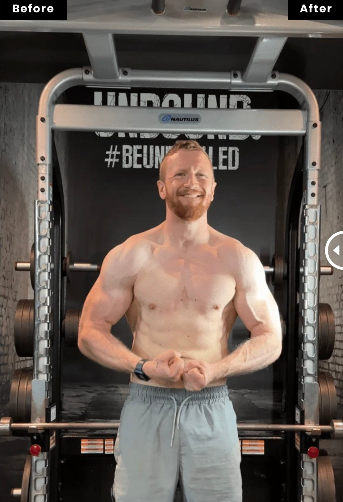 image comparison before